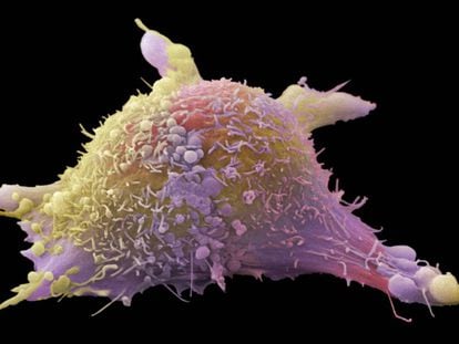 Inmunoterapia contra el cáncer: un nuevo paradigma
