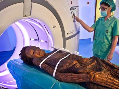 La momia guanche del Arqueológico Nacional, cuando fue sometida a una tomografía axial computarizada en el Hospital Quirón de Madrid.