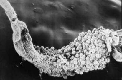 Porción del intestino infestada de 'Plasmodium'.
