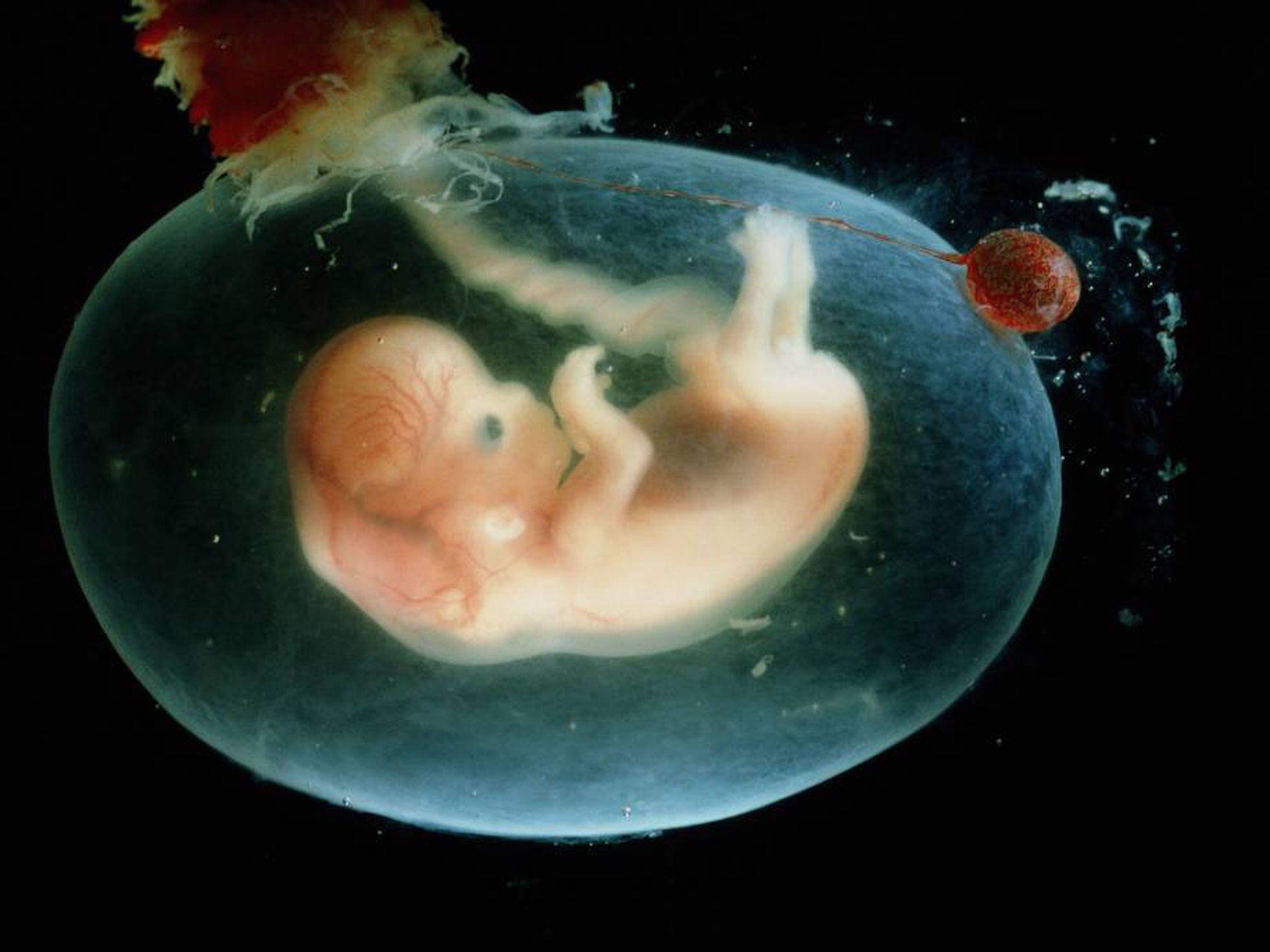piloto Meandro aislamiento Una mujer de 26 años da a luz a un bebé cuyo embrión se congeló hace 25 |  Mamas & Papas | EL PAÍS
