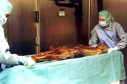Varios expertos examinan el cadáver de Ötzi, muerto por varios flechazos en los Alpes hace 5.000 años.