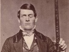 Phineas Gage junto a la barra que le atravesó el cerebro y cambió su personalidad