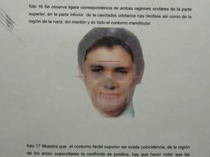 Imagen del análisis forense tras la exhumación.