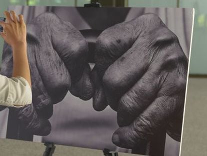Imagen de la exposición sobre artritis reumatoide en el Museo del Traje. (Cedida por los organizadores)