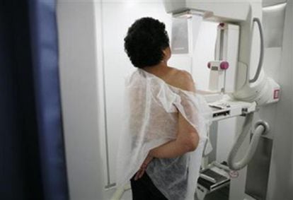 Un mujer se somete a una mamografía.