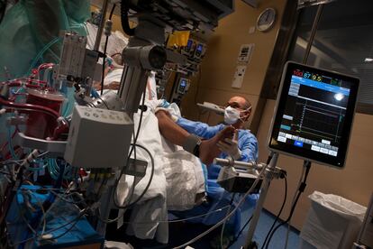 Un paciente en la UCI del Hospital Vall d'Hebron al que se le aplica el programa de tratamiento ECMO.