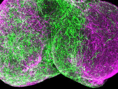Dos esferoides humanos ensamblados, el ventral a la izquierda, el dorsal a la derecha. Las neuronas inhibidoras (verde) están migrando a la zona dorsal y formando circuitos allí.