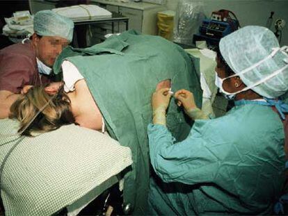 Dos médicos ponen una anestesia epidural a una mujer antes de un parto.