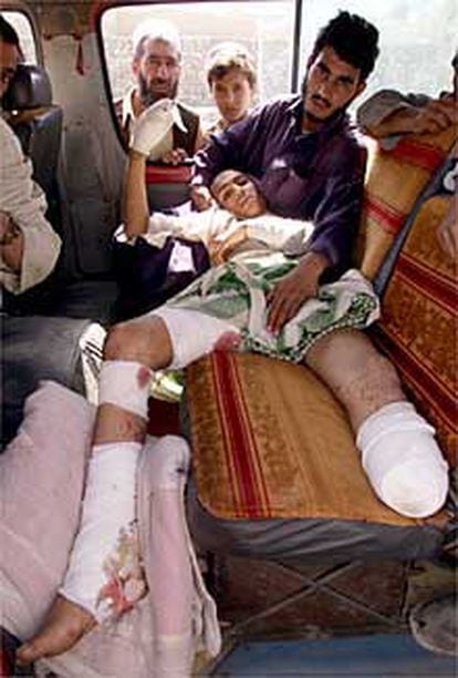Un afgano de 16 años es trasladado a un hospital de Jalalabad tras resultar herido en los ataques.