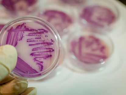 La 'Escherichia coli' (imagen de un cultivo) es una de las bacterias que más resistencia a antibióticos ha desarrollado.