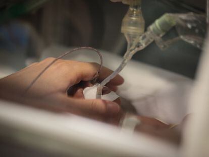 El aumento de nacimientos de bebés prematuros extremos implica que cada vez hay más recién nacidos que vienen al mundo entre las 23 y las 25 semanas de gestación
