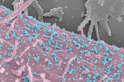 Una célula humana (rosa) libera exosomas (azules), en una imagen tomada con un microscopio electrónico de barrido.