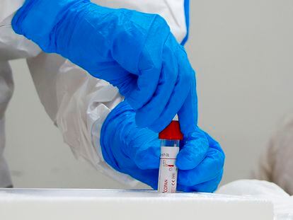 Un sanitario cierra el kit con el que se toman las muestras para detectar coronavirus en un centro médico de Israel.