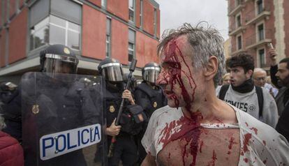 Un herido en las cargas en la escuela Mediterránea de Barcelona el 1-O.