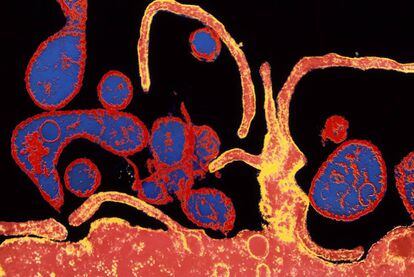 Microtograf&iacute;a electr&oacute;nica coloreada del virus de sarampi&oacute;n infectando una c&eacute;lula.