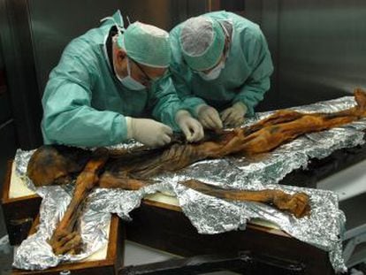 Ötzi, que murió asesinado hace 5.300 años en los Alpes italianos, comió una dieta rica en grasa que puede estar asociada a sus problemas cardiacos