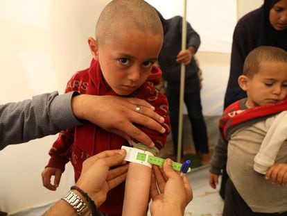 Un trabajador sanitario mide el brazo de Mohammad, de tres años, para determinar si sufre desnutrición, en Rafah, en el sur de Gaza, el 19 de marzo de 2024.