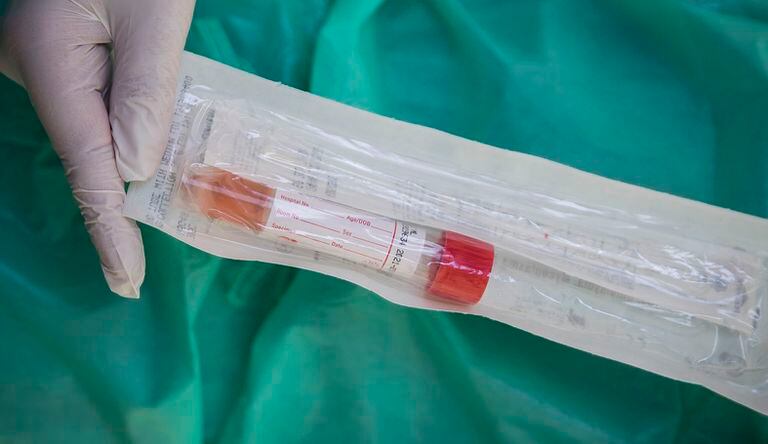 Un trabajador sanitario sostiene el 'covidauto', la pruebas del coronavirus que se realiza a pacientes sospechosos de portar el coronavirus, en sus propios vehículos sin que tengan que bajarse de ellos.