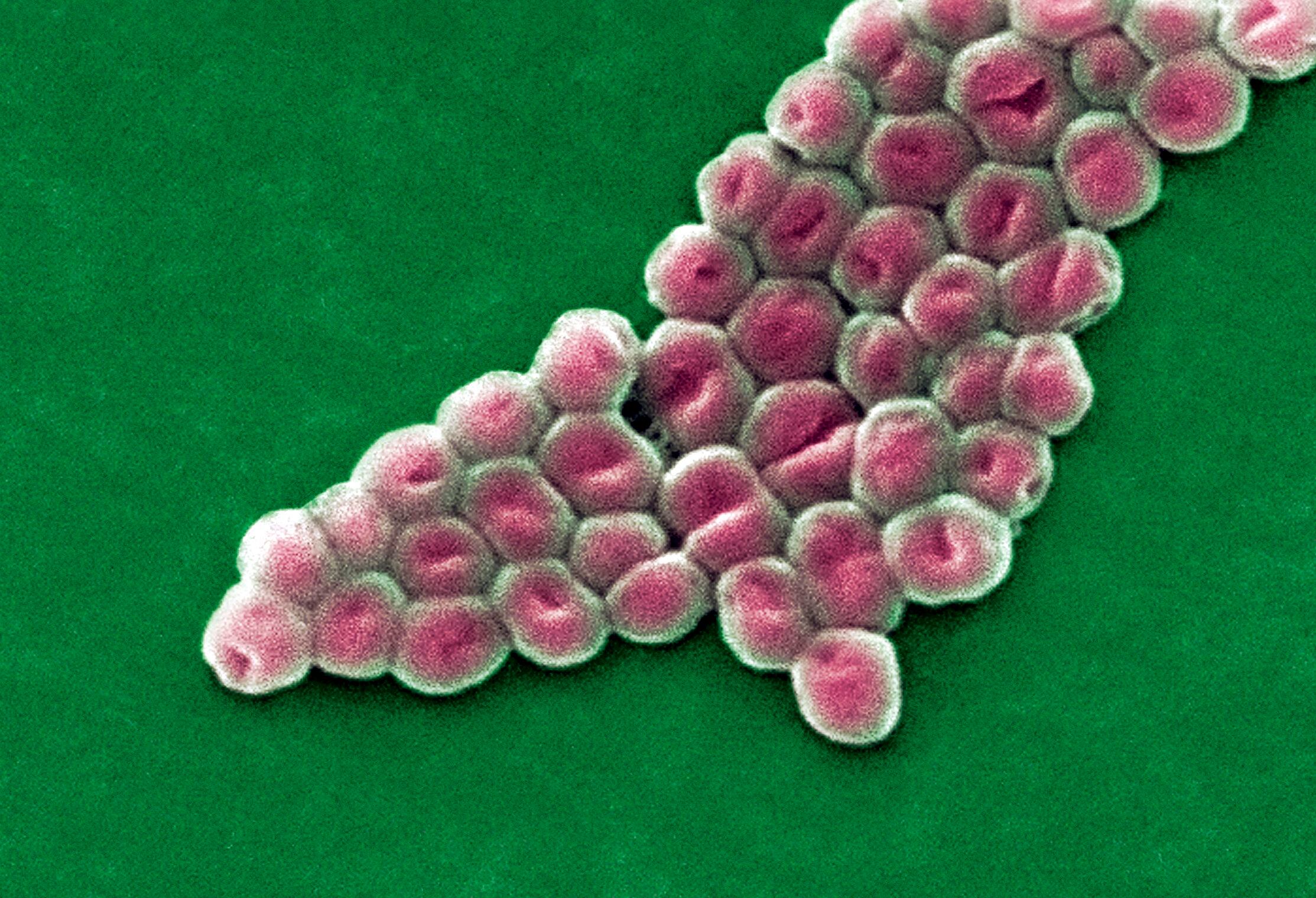 Superbacterias: la amenaza invisible que atenaza el mundo