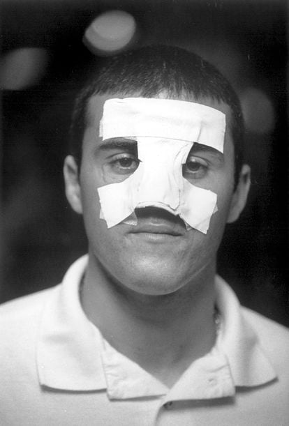 El 9 de julio de 1994, durante el Mundial de EE UU, el jugador italiano Mauro Tassotti rompió la nariz de un codazo a Luis Enrique. Dos días después, esta imagen fue portada en EL PAÍS.