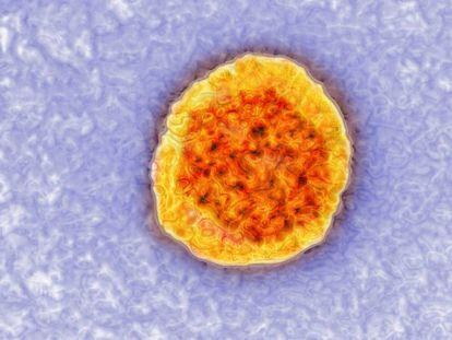 Imagen tomada con un microscopio del virus de la hepatitis C. 
