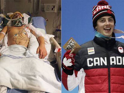 Mark McMorris, en el hospital en 2017 y este domingo celebrando su bronce en PyeongChang. 