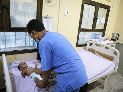 El doctor Aref, pediatra de MSF en el hospital de Ad Dahi, Yemen, atiende a Ibrahim Khalil, de seis meses.
