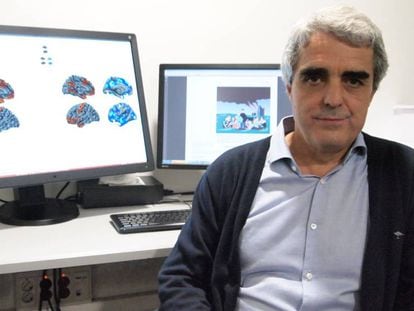 El doctor Pujol, del hospital del Mar, que ha liderado la investigación sobre el cerebro de los psicópatas