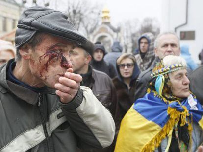 Un herido en la dispersi&oacute;n de la protesta, en Kiev.