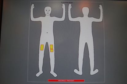 El monitor del nuevo escáner de Siemens muestra imágenes simbólicas de los cuerpos.