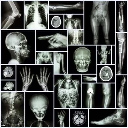 Radiografías de partes del cuerpo humano.