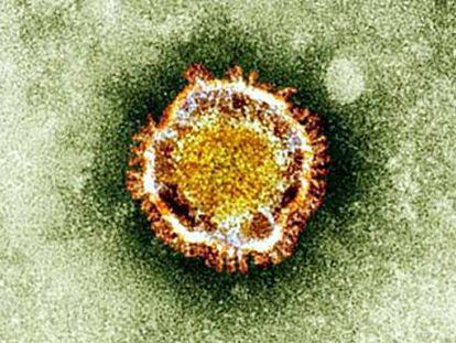 Imagen del virus que provoca la enfermedad.
