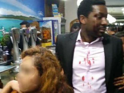 El intérprete africano Marius Makon fue golpeado el sábado con una botella en una cervecería por una mujer que lo llamó  negro de mierda 