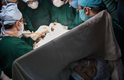 Momento de la operación quirúrgica a la que se sometió Abul Bandajjar para recuperar sus manos.