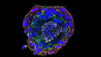 Un embrión humano de 11 días cultivado en el laboratorio.