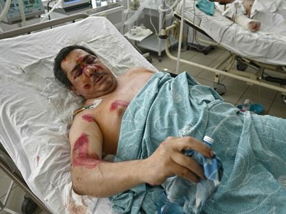 Un hombre se recupera en el Hospital Número Tres de Kremenchuk de las heridas que sufrió en el bombardeo ruso al centro comercial Amstor.