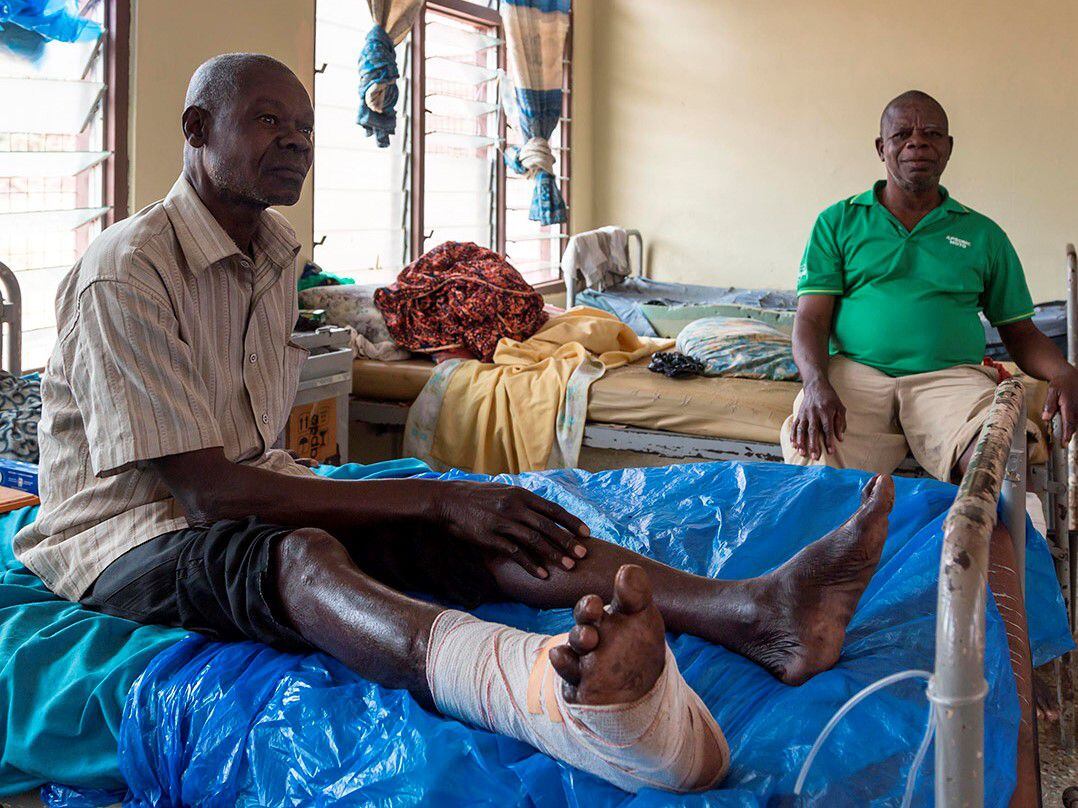 Jean Paul y Francis, afectados por úlcera de Buruli, se recuperan en el Hospital Amansie West de Accra, en Ghana, país donde Anesvad trabaja desde 1995 en la atención a enfermedades tropicales desatendidas.