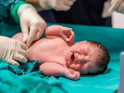 Un doctor corta el cordón umbilical a un recién nacido.