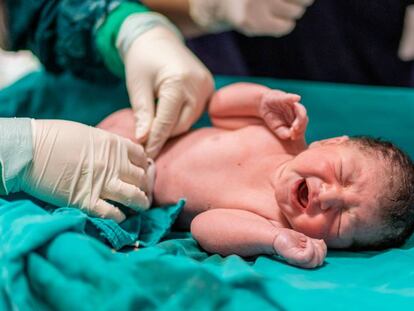 Un doctor corta el cordón umbilical a un recién nacido.