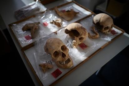 Tres de los restos óseos atribuidos o relacionados con Cristóbal Colón, en la Facultad de Medicina de Granada. 