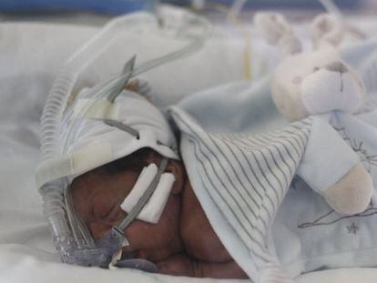 Mohamid nació con 12 semanas de adelanto y permanece ingresado en la UCI de La Paz.