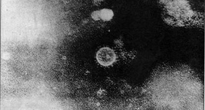 Imagen del virus de la hepatitis C.
