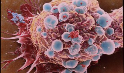 Célula de cáncer de mama.