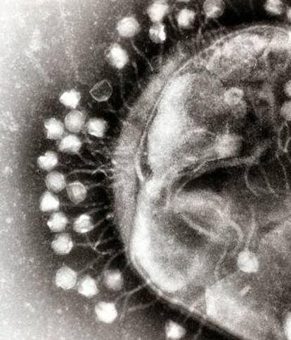 La mayoría de los virus son bacteriófagos. En la imagen, fagos adheridos a una bacteria.