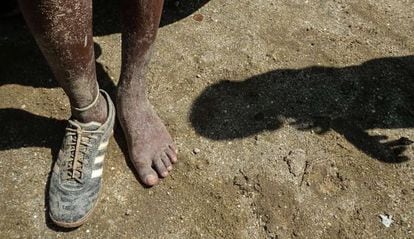 Un niño de la favela de Cidade de Deus calza un solo zapato.