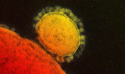 Imagen del coronavirus (amarillo) del Instituto Nacional para la Alergia y las Enferemdades Infecciosas y las Alergias (NIAID).