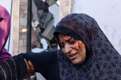 Una mujer palestina herida esperaba ser atendida por los servicios médicos en la ciudad de Rafah, al sur de la franja de Gaza. 