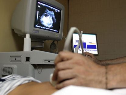 Un médico realiza una ecografía a una mujer embarazada.