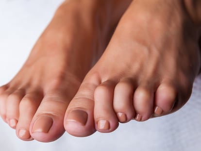 Se trata de un artículo de EL PAÍS Escaparate que describe la deformidad denominada "dedos en garra del pie".