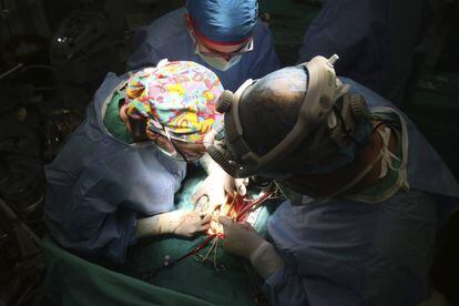 Operación de trasplante de corazón realizado en el hospital Reina Sofía de Córdoba.